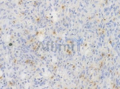 CPS1 Recombinant Rabbit mAb - BF4467 at 1/100 staining Human spleen tissue by IHC-P.