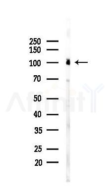 PKD1/PKC mu Recombinant Rabbit mAb - Western blot analysis of lysates from HUVEC cells(UV 30min treatment), using PKD1/PKC mu Recombinant Rabbit mAb at 1/1000 dilution.