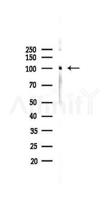 Golgin 97 Recombinant Rabbit mAb - Western blot analysis of lysates from 293 cells(UV 30min treatment), using Golgin 97 Recombinant Rabbit mAb at 1/1000 dilution.