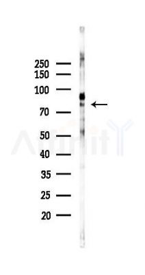 KIF2C Recombinant Rabbit mAb - Western blot analysis of lysates from 293 cells(UV 30min treatment), using KIF2C Recombinant Rabbit mAb at 1/1000 dilution.