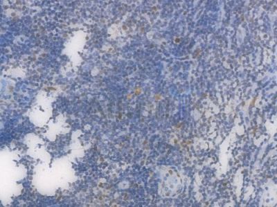 PRMT1 Recombinant Rabbit mAb - BF4473 at 1/100 staining Human tonsil tissue by IHC-P.