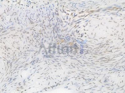 PRMT1 Recombinant Rabbit mAb - BF4473 at 1/100 staining Human ovarian tissue by IHC-P.