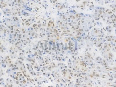 PRMT1 Recombinant Rabbit mAb - BF4473 at 1/100 staining Human pancreatic tissue by IHC-P.