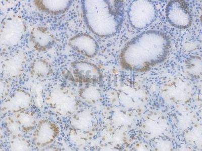 PRMT1 Recombinant Rabbit mAb - BF4473 at 1/100 staining Human gastric tissue by IHC-P.
