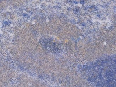 PRMT1 Recombinant Rabbit mAb - BF4473 at 1/100 staining Rat spleen tissue by IHC-P.