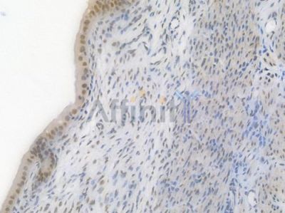 PRMT1 Recombinant Rabbit mAb - BF4473 at 1/100 staining Rat uterine tissue by IHC-P.