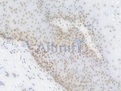 PRMT1 Recombinant Rabbit mAb - BF4473 at 1/100 staining Human esophageal tissue by IHC-P.