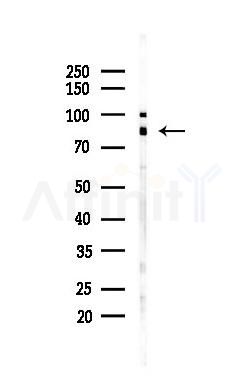 Cholinesterase/BCHE Recombinant Rabbit mAb - Western blot analysis of lysates from HUVEC cells(UV 30min treatment), using Cholinesterase/BCHE Recombinant Rabbit mAb at 1/1000 dilution.