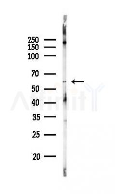 CYP26B1 Recombinant Rabbit mAb - Western blot analysis of lysates from Rat lung, using CYP26B1 Recombinant Rabbit mAb at 1/1000 dilution.