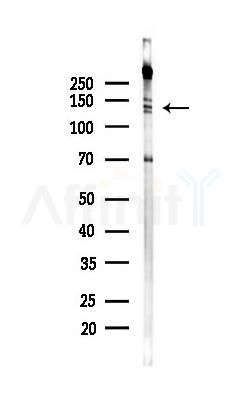 SLC8A1 Recombinant Rabbit mAb - Western blot analysis of lysates from HUVEC cells(UV 30min treatment), using SLC8A1 Recombinant Rabbit mAb at 1/1000 dilution.