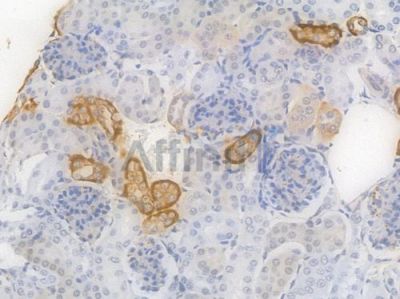 SLC8A1 Recombinant Rabbit mAb - BF4479 at 1/100 staining Mouse renal tissue by IHC-P.