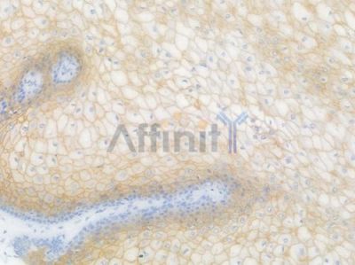SLC8A1 Recombinant Rabbit mAb - BF4479 at 1/100 staining Human esophageal tissue by IHC-P.