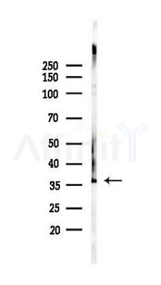 DEGS1 Recombinant Rabbit mAb - Western blot analysis of lysates from 293 cells(UV 30min treatment), using DEGS1 Recombinant Rabbit mAb at 1/1000 dilution.
