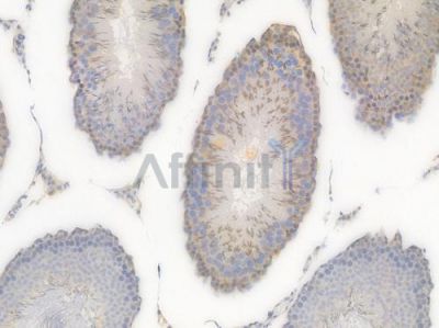 beta I Tubulin Recombinant Rabbit mAb - BF4483 at 1/100 staining Rat testicular tissue by IHC-P.