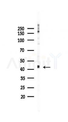 ACAT1 Recombinant Rabbit mAb - Western blot analysis of lysates from 293 cells(UV 30min treatment), using ACAT1 Recombinant Rabbit mAb at 1/1000 dilution.