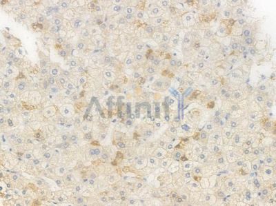 ACAT1 Recombinant Rabbit mAb - BF4484 at 1/100 staining Human liver tissue by IHC-P.