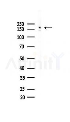 COL18A1 Recombinant Rabbit mAb - Western blot analysis of lysates from HUVEC cells(UV 30min treatment), using COL18A1 Recombinant Rabbit mAb at 1/1000 dilution.