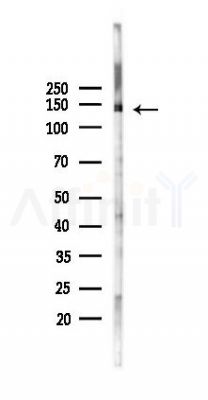 BUB1B Recombinant Rabbit mAb - Western blot analysis of lysates from 293 cells(UV 30min treatment), using BUB1B Recombinant Rabbit mAb at 1/1000 dilution.