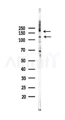 TRIM24 Recombinant Rabbit mAb - Western blot analysis of lysates from 293 cells(UV 30min treatment), using TRIM24 Recombinant Rabbit mAb at 1/1000 dilution.