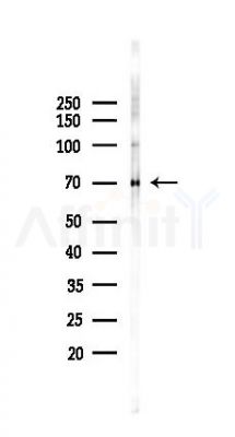 PRMT5 Recombinant Rabbit mAb - Western blot analysis of lysates from 293 cells(UV 30min treatment), using PRMT5 Recombinant Rabbit mAb at 1/1000 dilution.