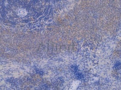 PRMT5 Recombinant Rabbit mAb - BF4500 at 1/100 staining Rat spleen tissue by IHC-P.