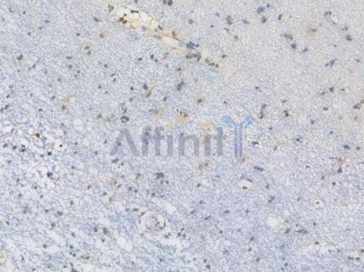 PRMT5 Recombinant Rabbit mAb - BF4500 at 1/100 staining Human brain tissue by IHC-P.
