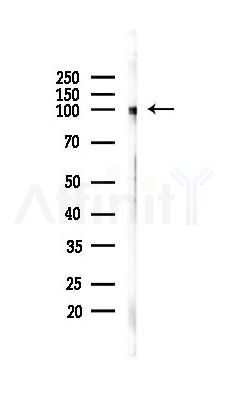 LGR6 Recombinant Rabbit mAb - Western blot analysis of lysates from HUVEC cells(UV 30min treatment), using LGR6 Recombinant Rabbit mAb at 1/1000 dilution.