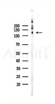 USP7 Recombinant Rabbit mAb - Western blot analysis of lysates from 293 cells(UV 30min treatment), using USP7 Recombinant Rabbit mAb at 1/1000 dilution.