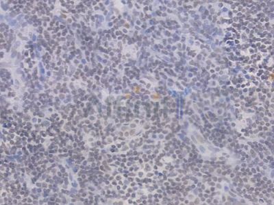 Phospho-POLR2A (Ser2) Recombinant Rabbit mAb - BF4510 at 1/100 staining Human tonsil tissue by IHC-P.