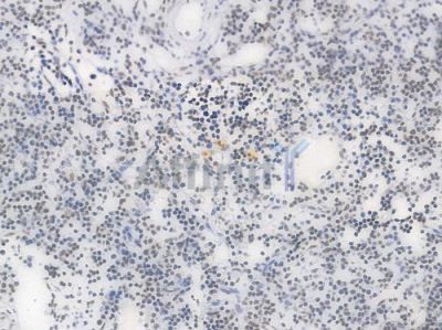 Phospho-POLR2A (Ser2) Recombinant Rabbit mAb - BF4510 at 1/100 staining Human lymph node tissue by IHC-P.
