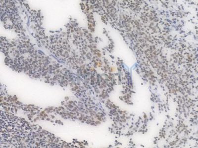 Phospho-POLR2A (Ser2) Recombinant Rabbit mAb - BF4510 at 1/100 staining Human tonsil tissue by IHC-P.