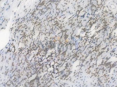 RPA32/RPA2 Recombinant Rabbit mAb - BF4515 at 1/100 staining Human tonsil tissue by IHC-P.