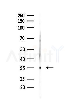 Glycophorin A Recombinant Rabbit mAb - Western blot analysis of lysates from PC12 cells(UV 30min treatment), using Glycophorin A Recombinant Rabbit mAb at 1/1000 dilution.