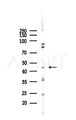 ARP2 Recombinant Rabbit mAb - Western blot analysis of lysates from HUVEC cells(starvation 24h treatment), using ARP2 Recombinant Rabbit mAb at 1/1000 dilution.