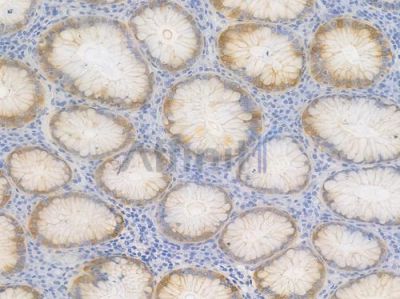 PI3 Kinase Class III Recombinant Rabbit mAb - BF4520 at 1/100 staining Human gastric tissue by IHC-P.