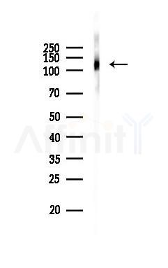 DDB1 Recombinant Rabbit mAb - Western blot analysis of lysates from Rat lung, using DDB1 Recombinant Rabbit mAb at 1/1000 dilution.