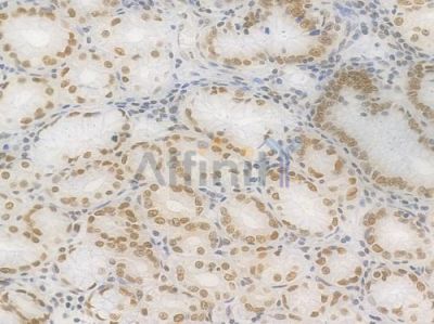 Ku70 Recombinant Rabbit mAb - BF4523 at 1/100 staining Human gastric tissue by IHC-P.