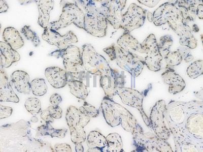 Ku70 Recombinant Rabbit mAb - BF4523 at 1/100 staining Human placental tissue by IHC-P.