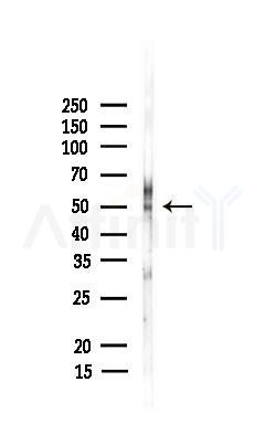 ESRRA Recombinant Rabbit mAb - Western blot analysis of lysates from PC12 cells(UV 30min treatment), using ESRRA Recombinant Rabbit mAb at 1/1000 dilution.