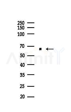 EPXH2 Recombinant Rabbit mAb - Western blot analysis of lysates from Mouse kidney, using EPXH2 Recombinant Rabbit mAb at 1/1000 dilution.