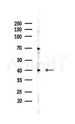 HP Recombinant Rabbit mAb - Western blot analysis of lysates from PC12 cells(UV 30min treatment), using HP Recombinant Rabbit mAb at 1/1000 dilution.