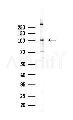 GRID2 Recombinant Rabbit mAb - Western blot analysis of lysates from PC12 cells(UV 30min treatment), using GRID2 Recombinant Rabbit mAb at 1/1000 dilution.