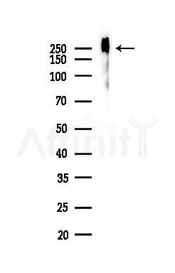 Phospho-POLR2A (Ser5) Recombinant Rabbit mAb - Western blot analysis of lysates from B16F10-LUC cells(heat-shock 45min treatment), using Phospho-POLR2A (Ser5) Recombinant Rabbit mAb at 1/1000 dilution.