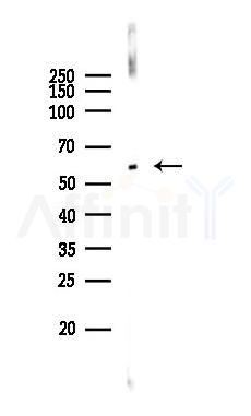 TGFBI Recombinant Rabbit mAb - Western blot analysis of lysates from Rat lung, using TGFBI Recombinant Rabbit mAb at 1/1000 dilution.