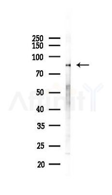 XRCC1 Recombinant Rabbit mAb - Western blot analysis of lysates from B16F10-LUC cells(heat-shock 45min treatment), using XRCC1 Recombinant Rabbit mAb at 1/1000 dilution.