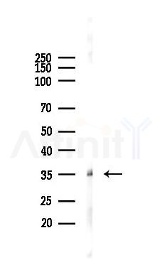 PITX3 Recombinant Rabbit mAb - Western blot analysis of lysates from HUVEC cells(starvation 24h treatment), using PITX3 Recombinant Rabbit mAb at 1/1000 dilution.