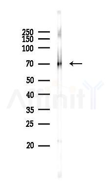 MYST2 Recombinant Rabbit mAb - Western blot analysis of lysates from Rat lung, using MYST2 Recombinant Rabbit mAb at 1/1000 dilution.