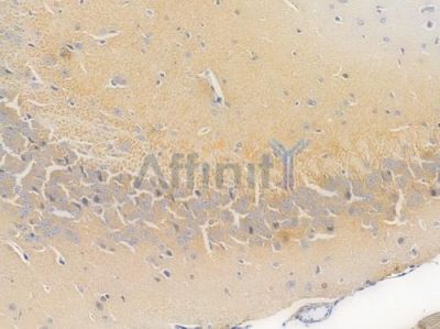GSTA4 Recombinant Rabbit mAb - BF4548 at 1/100 staining Mouse brain tissue by IHC-P.