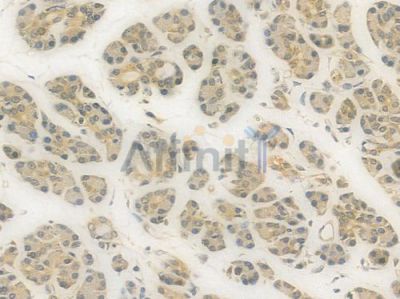 ABCD3 Recombinant Rabbit mAb - BF4551 at 1/100 staining Human pancreatic tissue by IHC-P.