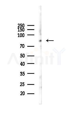 PKC theta Recombinant Rabbit mAb - Western blot analysis of lysates from HUVEC cells(starvation 24h treatment), using PKC theta Recombinant Rabbit mAb at 1/1000 dilution.